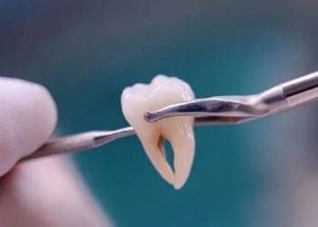 Hamba eemaldamine: müüdid, hirmud ja tegelikud faktid